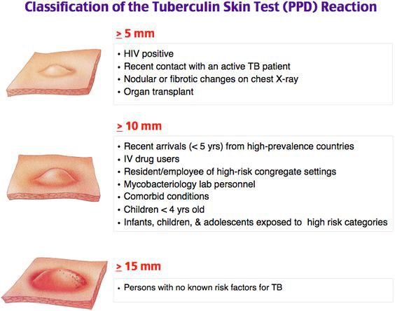 Intradermal Injection ID intradermal-injection-id
