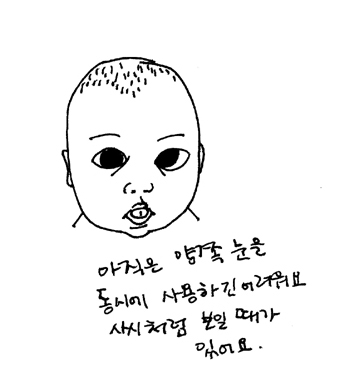 신생아 사시, 가성사시, 선천성내사시 신생아 사시, 가성사시, 선천성내사시
