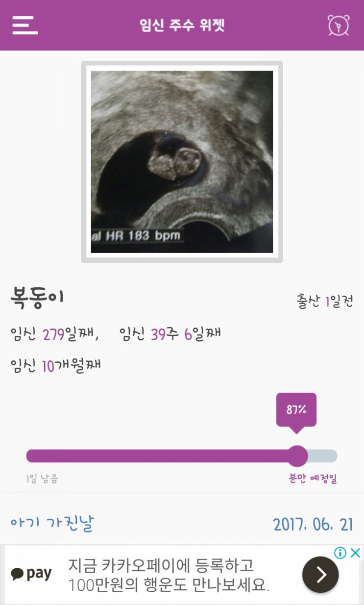 [20180328]송파 고은빛산부인과에서 둘째 복동이 출산했어요(40주예정일 유도분만.자연분만.가족분만실.르봐이예분만)