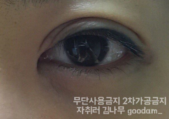 눈 아토피 / 성인아토피 / 눈가 아토피 / 2년 2개월의 기록 / 원인 / 좋아지는 방법