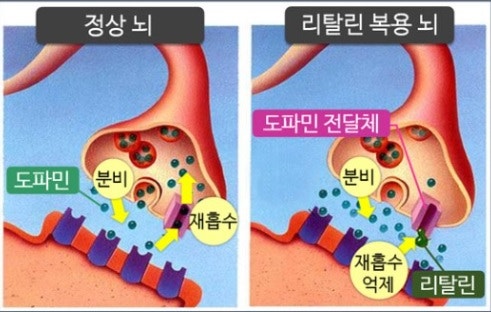 메틸페니데이트 부작용(페니드, 콘서타, 콘써타, 메타데이트, 공부잘하는 약, Concerta, Penid) : 네이버 블로그 메틸페니데이트 부작용(페니드, 콘서타, 콘써타, 메타데이트, 공부잘하는 약, Concerta, Penid) : 네이버 블로그