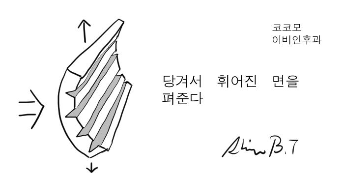  비중격만곡증수술의 핵심원리  