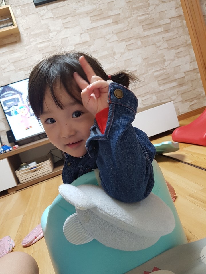 29개월 아기발 티눈 - 초기에 없애기!
