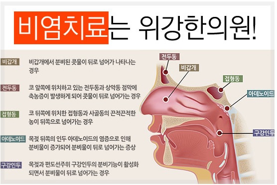 비염의 대표 증상 8가지 (1) - 콧물, 후비루, 재채기 2