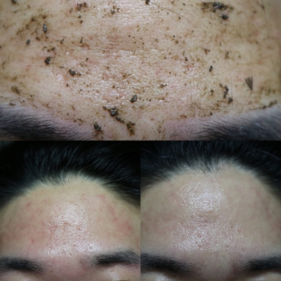  쥴레 해초필링 셀프박피 간편하게 사용후기