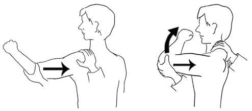 방카르트 병변(Bankart lesion) / 슬랩 병변(SLAP lesion) : 네이버 블로그
