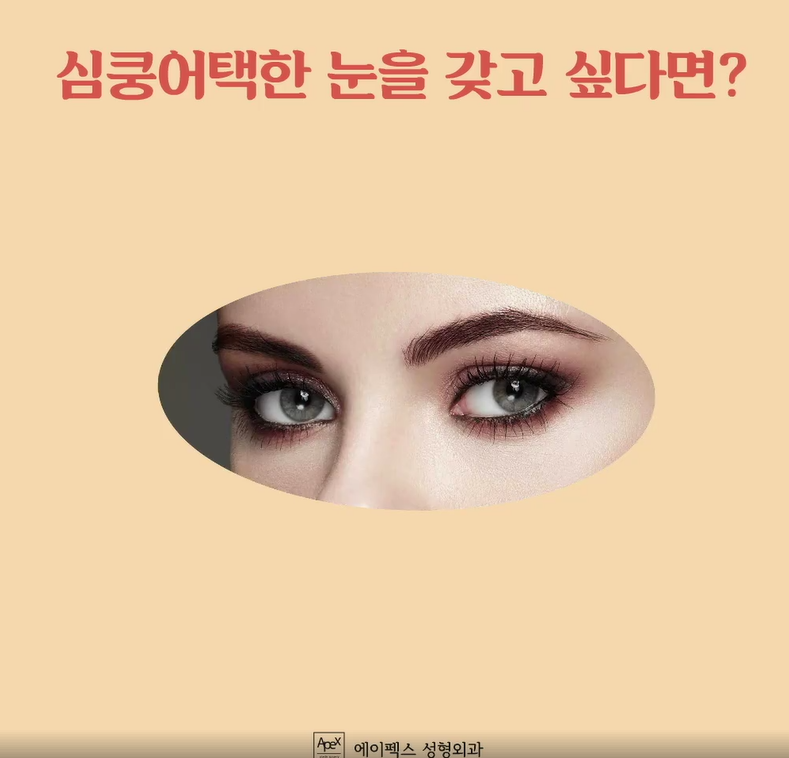 자연스러운 눈성형 에이펙스성형외과