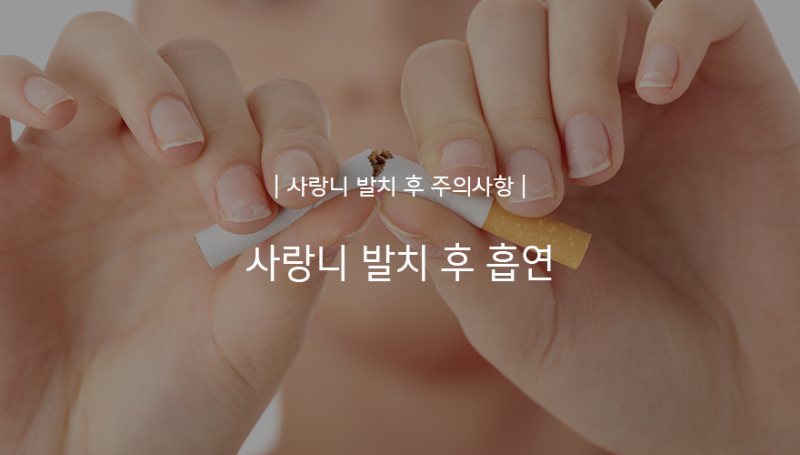 사랑니 발치 후 흡연/음주 당일 가능할까? 9