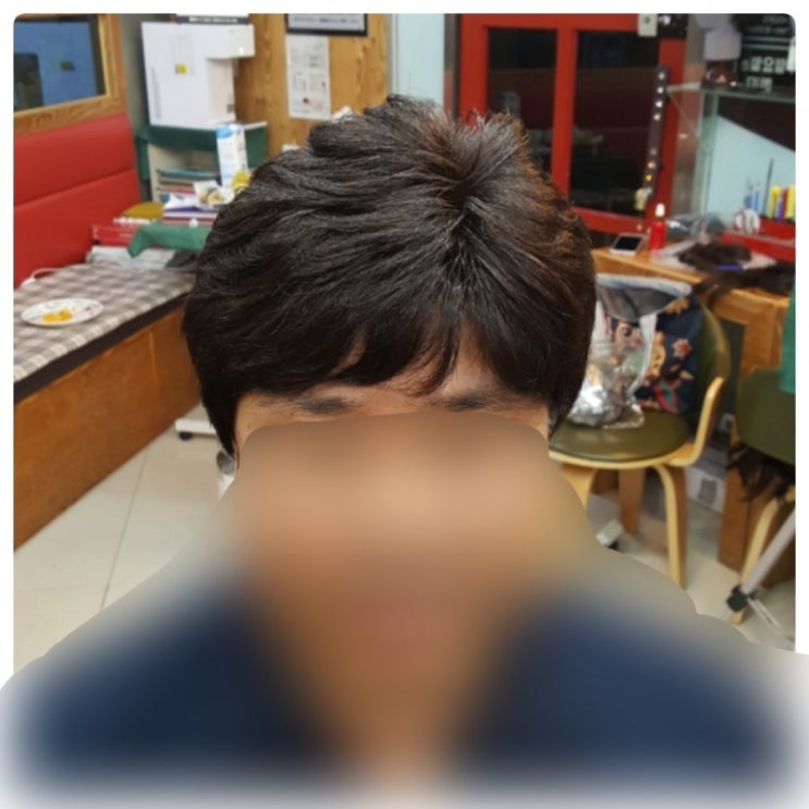 춘천가발 김호증모 흉터ㆍ맞춤가발~