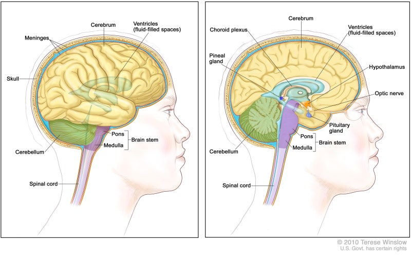 뇌종양 요약 (Brain Tumor) : 네이버 블로그
