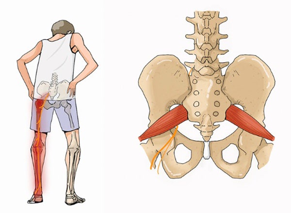 좌골신경통 영등포구 도수치료센터에서 시원하게 3