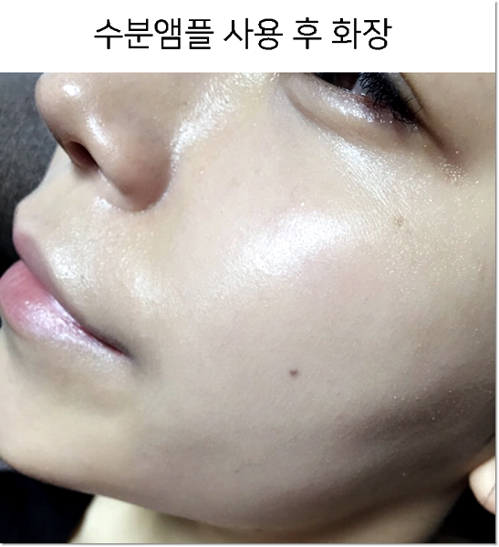 수분이 많은 미백 얼룩 앰플을 바르는 순서 6