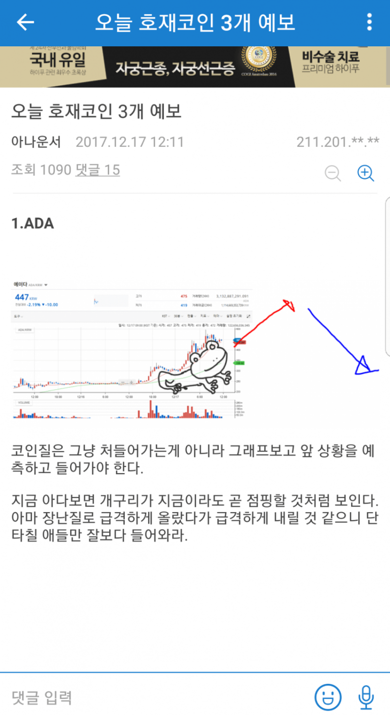 주식 차트 보기에는 그림 매매법이 있습니다. : 네이버 블로그