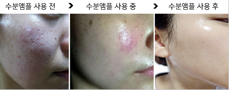 수분이 많은 미백 얼룩 앰플을 바르는 순서 3