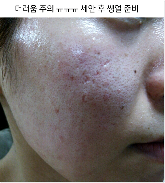 수분이 많은 미백 얼룩 앰플을 바르는 순서 9