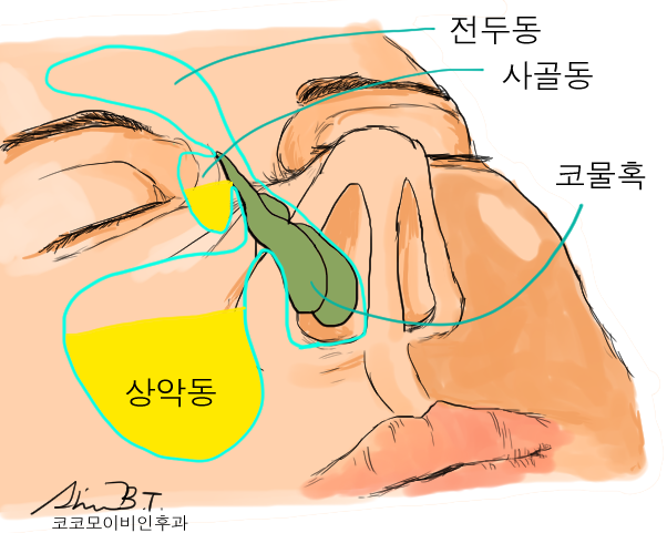  코물혹수술로 코물혹에 의한 코골이는 완치할 수 있어