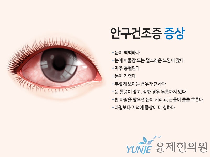 안구건조증과 노안, 눈충혈 민간요법 완치 성공담 [스크랩] - 이슈칼럼
