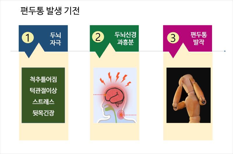 신경정신과한의원 두통에서 벗어나고 싶다면