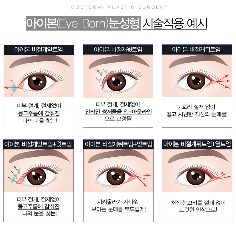 섹시한 눈을 원한다면 쌍꺼풀 리프팅 수술