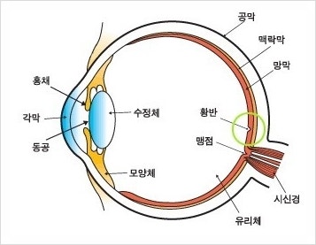[아이리움 망막질환클리닉] 3대 실명질환 황반변성?!