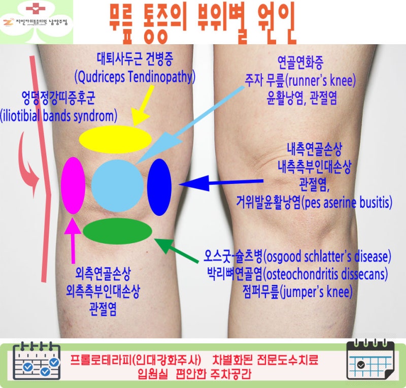 reason for signaling knee pain arthritis