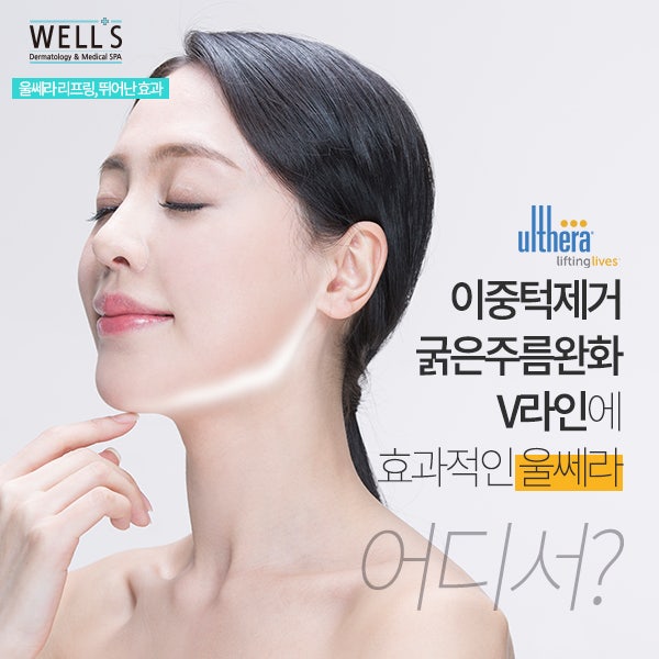 이중턱 리프팅 팁 공유 #