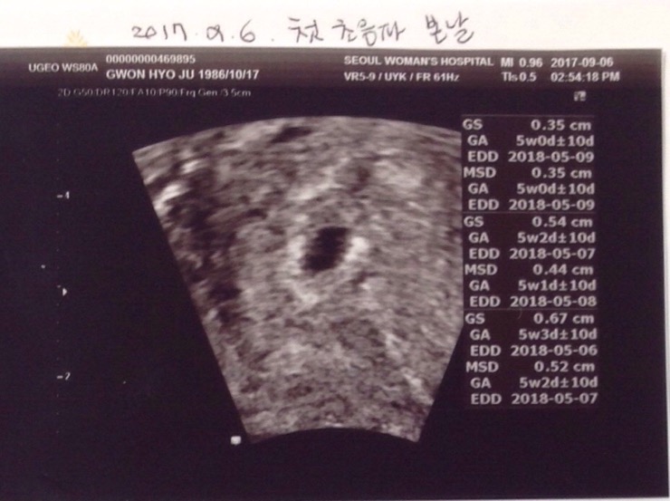  둘째 태몽(코끼리,복숭아)과 태명짓기️