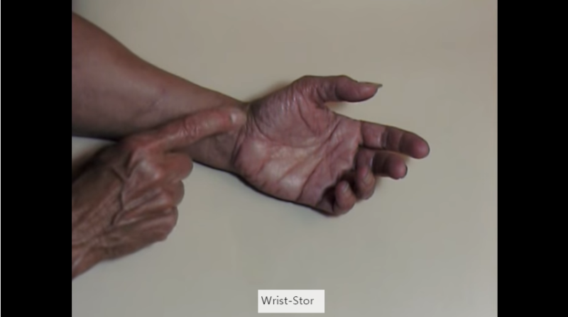 If you're thinking about how to treat Busan Wrist Tunnel Syndrome Hospital