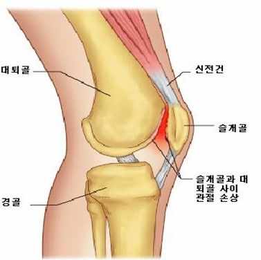 스키니 진/요가바지/컴프레션 레깅스 3