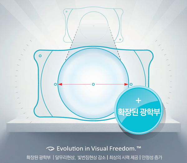 렌즈삽입술 난시교정 효과를 높이는 핵심요소는?