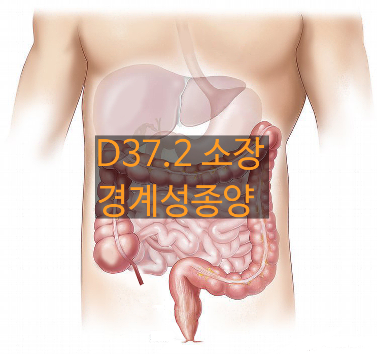 D37.2로 분류되는 유암종과 기질종양 암보험금?