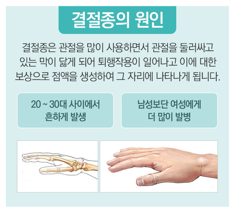 손목결절종병원의 증상에 맞는 치료로