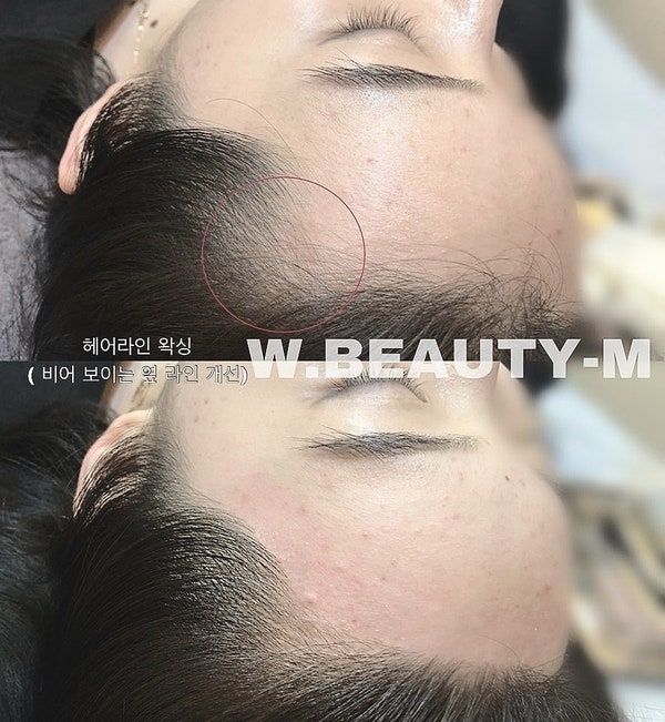 ■진주헤어라인왁스,진주아이브로우버,진주눈썹왁싱,진주브라질리언왁싱,진주임부왁싱,진주헤어라인교정,진주헤어라인시술,진주m자임마개선,진주삼자액자개선, 진주잔사머리정리 ■