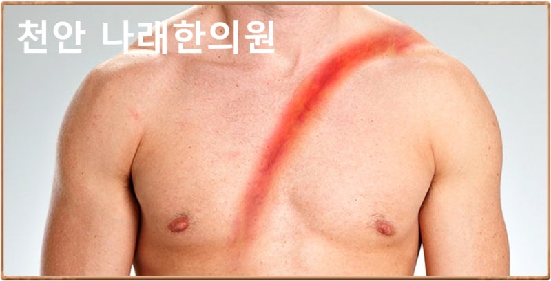 가슴 통증에서 벗어나는 방법 7