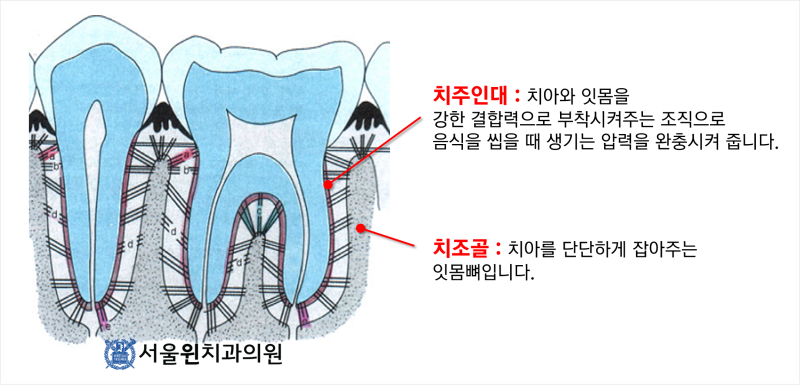 배곧치과 ) 서울윈치과와 함께하는 자연치아 살리기 혜택 안내 : 네이버 블로그