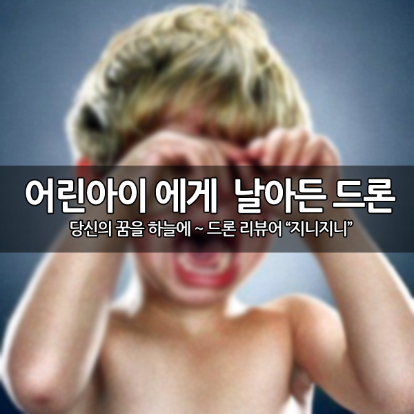 날아든 드론에 얼굴을 크게 다친 2살 아이... 날아든 드론에 얼굴을 크게 다친 2살 아이...