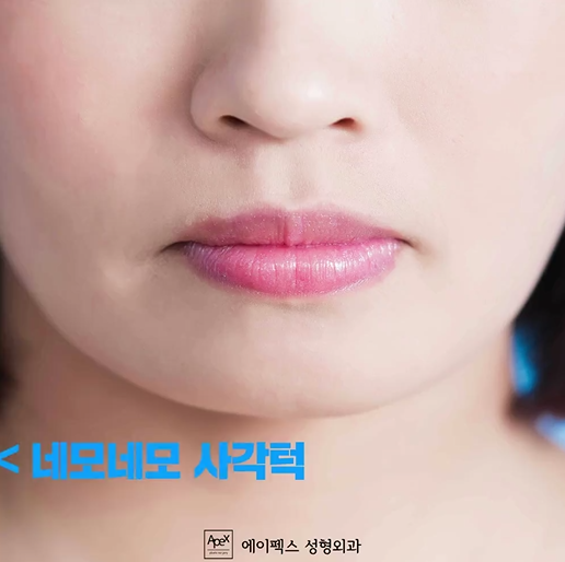 턱보톡스의 모든 궁금증 해결!