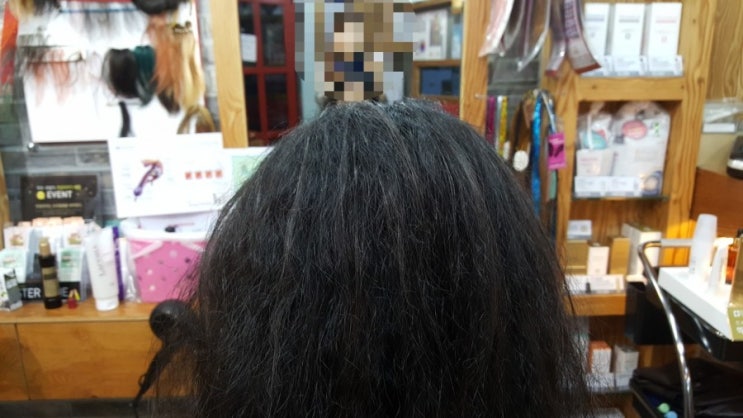  앞머리 탑 가르마 정수리 숱보강!! 다증모술과 보톡스증모술로 해보세요~~^^