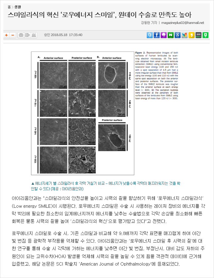 원데이라식 로우에너지스마일이 주목받는 이유
