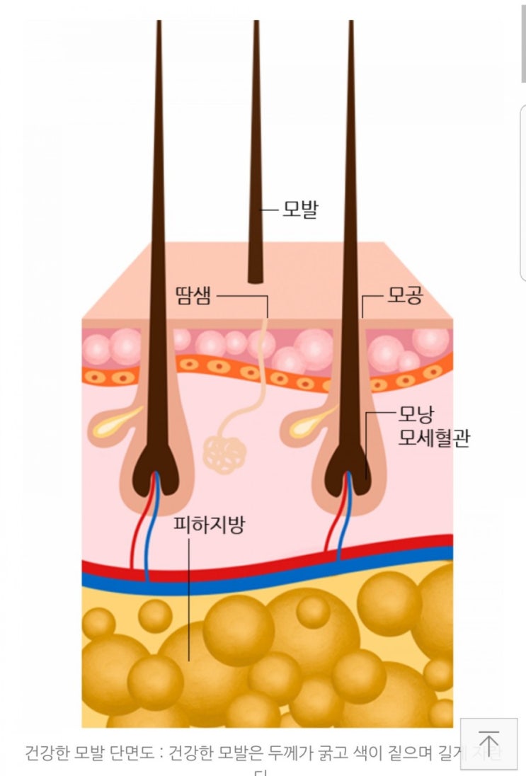 춘천가발 이은주헤어살롱이 알아본 탈모의 원인과 증상~