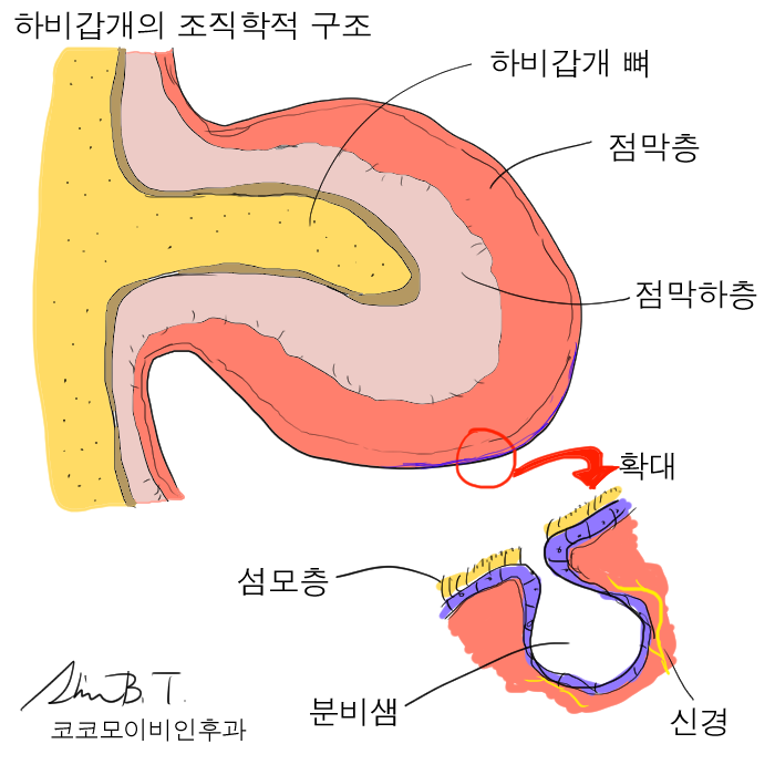  알레르기비염수술 효과와 언제 필요한지 궁금하시다면