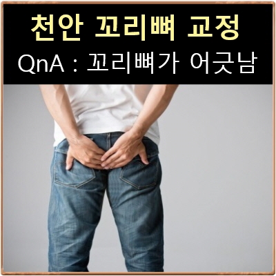  꼬리뼈교정 문의상담 실례C528 : 꼬리뼈 어긋난거 교정되나요? : 천안 나래 한의원