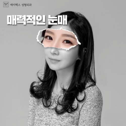 자연스러운 성형 에이펙스!!