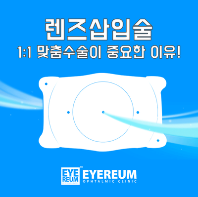 렌즈삽입술, 1:1맞춤형으로 완성하세요!