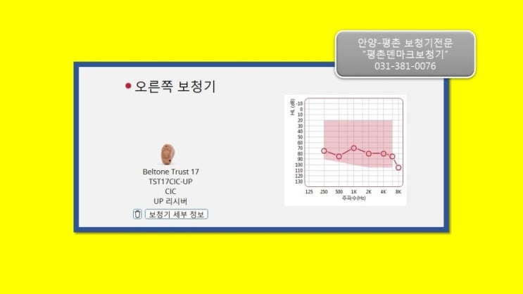  귓속형보청기 안양보청기에서 알려드릴게요