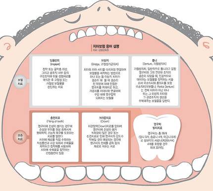 치아보험, 묻지도 따지지도 않으면 큰일나요