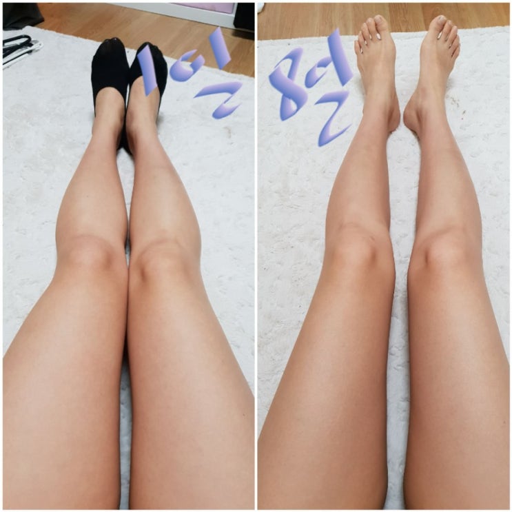  키토제닉 다이어트 키토제닉 식단 일주일 후기
