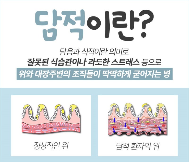 오른쪽 옆구리 통증이 있을 때 담적치료 네이버 블로그