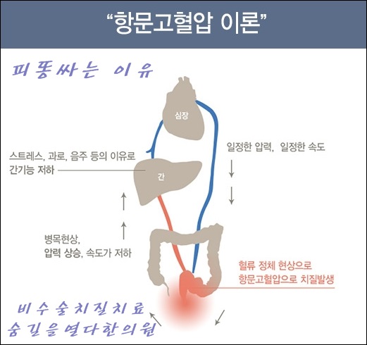 피똥싸는이유 5가지 치질이 아닐수도 있어요 4