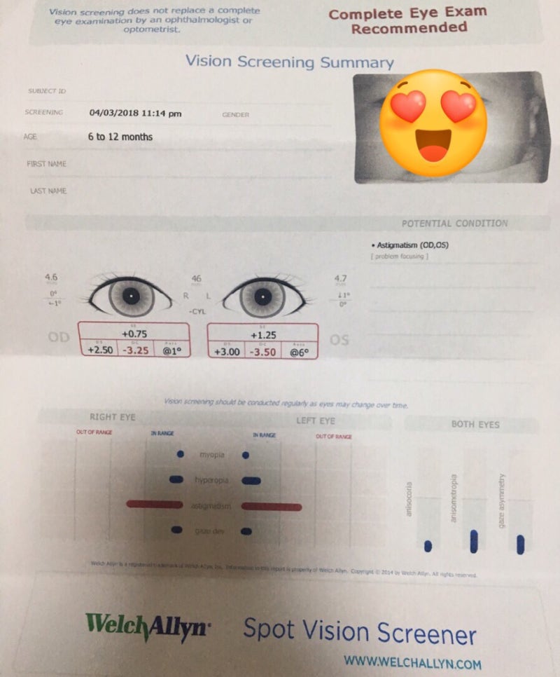 생후 6개월에 알게 된 유아 난시 : 네이버 블로그